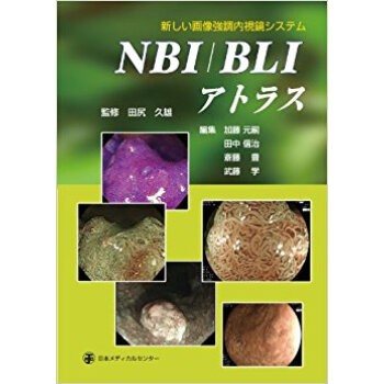 Nbi/Bliアトラス 新しい畫像強調內視鏡システム pdf epub mobi 下载