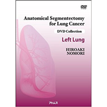 肺癌の解剖学的区域切除術 左肺 Dvd pdf epub mobi 下载