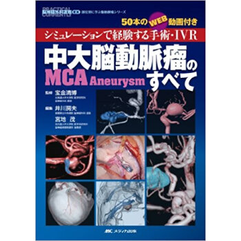 中大脳動脈瘤〈Mca Aneurysm〉のすべて シミュレーションで経験する手術?Ivr 50本 pdf epub mobi 下载