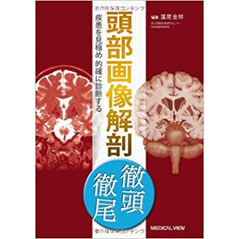 頭部畫像解剖徹頭徹尾 疾患を見極め的確に診斷する pdf epub mobi 下载