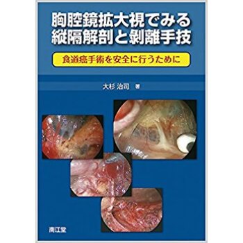 胸腔鏡拡大視でみる縦隔解剖と剝離手技 pdf epub mobi 下载