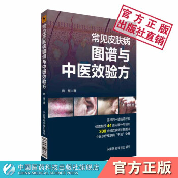 常見皮膚病圖譜與中醫效驗方 中國醫藥科技齣版社 pdf epub mobi 下载