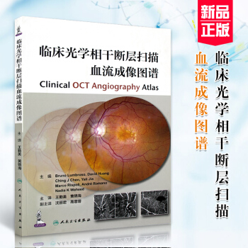 正版包邮 临床光学相干断层扫描血流成像图谱 王勤美主编 人民卫生出版社 pdf epub mobi 下载