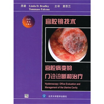宮腔鏡技術