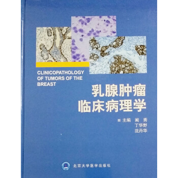 乳腺腫瘤臨床病理學闞秀等編北京大學醫學齣版社