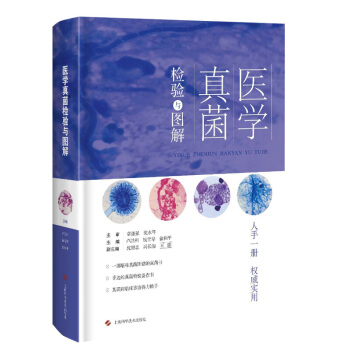 京东自营 正版 医学真菌检验与图解 卢洪洲 钱雪琴 上海科学技术出版社9787547837 pdf epub mobi 电子书 下载