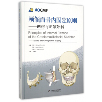 顱頜麵骨內固定原則--創傷與正頜外科(精) pdf epub mobi 電子書 下載