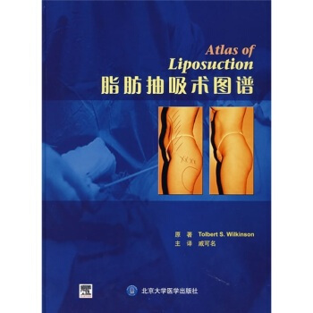 脂肪抽吸術圖譜 pdf epub mobi 電子書 下載