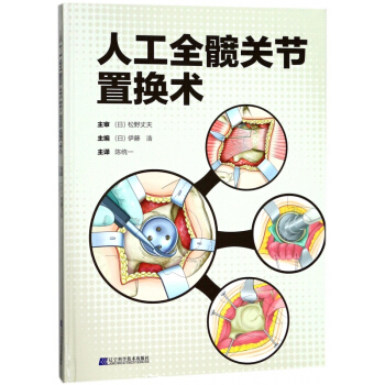人工全髖關節置換術(精) pdf epub mobi 下载