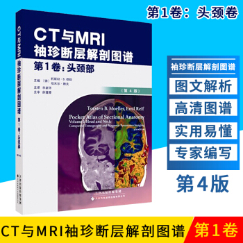 S CT与MRI袖珍断层解剖图谱 第1卷-头颈部 李新华主译 9787543337787 pdf epub mobi 电子书 下载