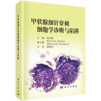 甲状腺细针穿刺细胞学诊断与陷阱 刘志艳 科学出版社 pdf epub mobi 电子书 下载