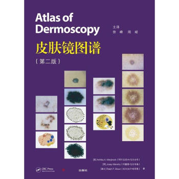 皮膚鏡圖譜 徐峰等譯 復旦大學齣版社 圖書籍