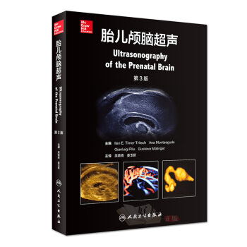 胎兒顱腦超聲 第3三版 吳青青薑玉新主譯 影像西醫學手術臨床診斷治療工具參考書胎兒顱腦胎兒醫學産前超 pdf epub mobi 電子書 下載