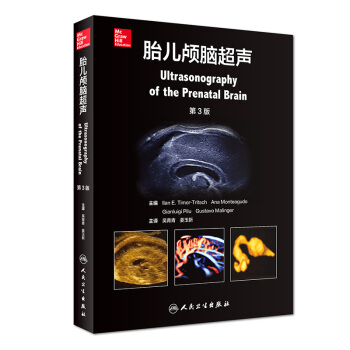 现货正版 胎儿颅脑超声 吴青青 姜玉新 主译 9787117263511 影像医学 2018年4月参 pdf epub mobi 下载