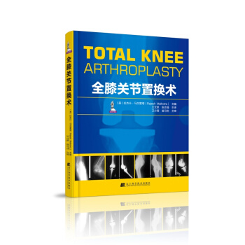 全膝關節置換術（膝關節置換手術） （美）拉傑什?馬爾霍塔 主編 2018年06月齣版 pdf epub mobi 下载