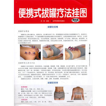 便携式拔罐疗法挂图(赠光盘) 9787538183689